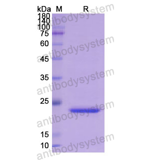 重組SFTPB蛋白,Recombinant Human SFTPB, N-His