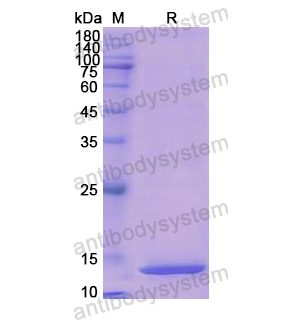 重組MSMB蛋白,Recombinant Human MSMB, N-His