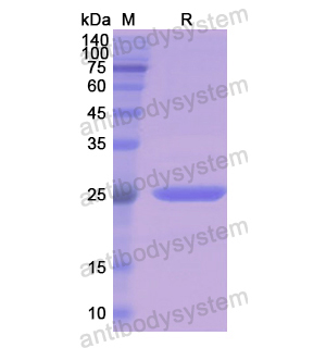 重组CD271/NGFR蛋白,Recombinant Human CD271/NGFR, N-His