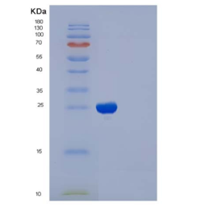 Recombinant Human CD122 / IL-2RB Protein