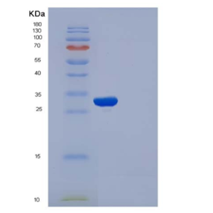 Recombinant Human APOA1 / ApoAI Protein (His tag)
