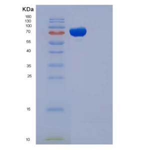 Recombinant Human Complement C5a Protein