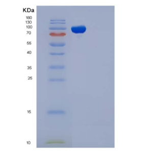Recombinant Mouse ICAM-1 / CD54 Protein (His & Fc tag)
