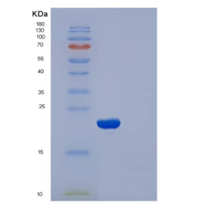Recombinant Human CFL2 / cofilin 2 / ADF Protein (His tag)
