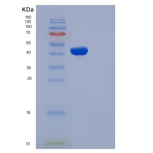 Recombinant Human MAX Protein (His &GST Tag),Recombinant Human MAX Protein (His &GST Tag)