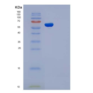 Recombinant Human ADSL / Adenylosuccinate Lyase Protein (His tag)