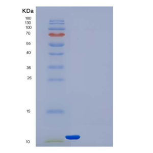 Recombinant Human Thioredoxin / TXN / SASP Protein