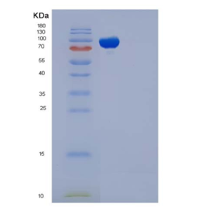 Recombinant Human EED / Embryonic Ectoderm Development Protein (His & GST tag)