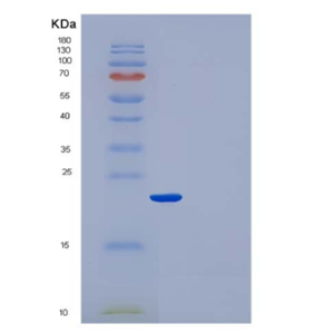 Recombinant Human CRP / C-Reactive Protein