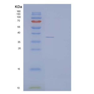 Recombinant Human ACYP1 Protein (GST Tag)