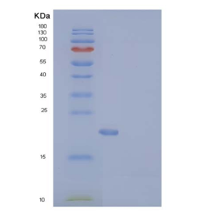 Recombinant Human CD137 / 4-1BB / TNFRSF9 Protein (His tag)