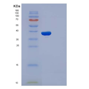 Recombinant Human IL1R1 / CD121a Protein (His tag),Recombinant Human IL1R1 / CD121a Protein (His tag)