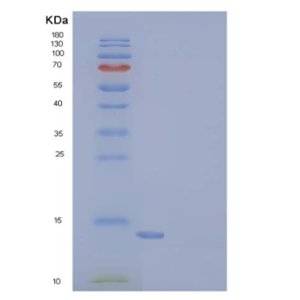 Recombinant Human LAIR2 / CD306 Protein, Low Endotoxin,Recombinant Human LAIR2 / CD306 Protein, Low Endotoxin