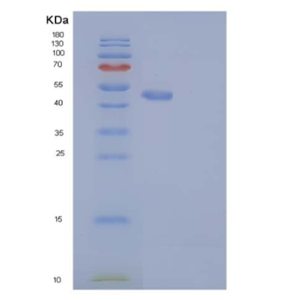 Recombinant Human RAB27B Protein (Fc tag)