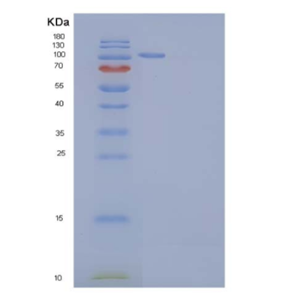 Recombinant Mouse AARS / alanyl-tRNA synthetase Protein (His tag)