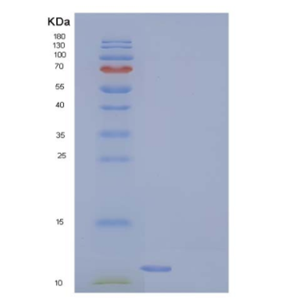 Recombinant Human COX5B Protein (His tag)