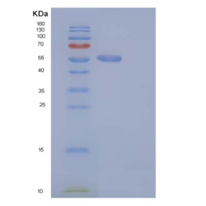 Recombinant Mouse S100A15 / S100A7A Protein (His & MBP tag)