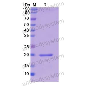 Recombinant Human CRH, N-His