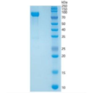 Recombinant Human MMP-2 Protein