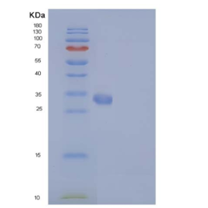 Recombinant Mouse IL17RA / IL17R / CD217 Protein (His tag)