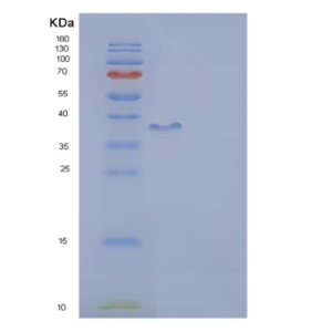 Recombinant Human DCX Protein (aa 45-150, GST tag)
