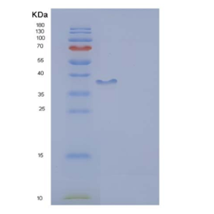 Recombinant Human DCX Protein (aa 45-150, GST tag),Recombinant Human DCX Protein (aa 45-150, GST tag)