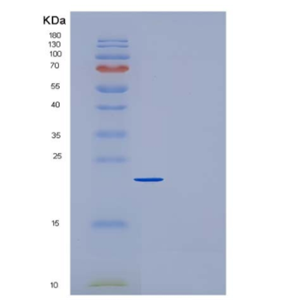 Recombinant Mouse CRP / C-Reactive Protein (His tag)