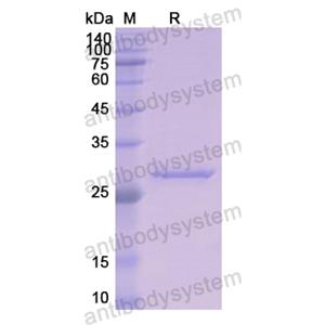 重組KLK1蛋白,Recombinant Human KLK1, N-His