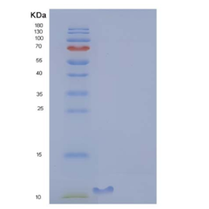 Recombinant Rat CLPS / Colipase Protein (His Tag),Recombinant Rat CLPS / Colipase Protein (His Tag)
