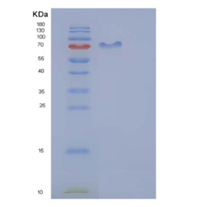 Recombinant Mouse CDC37 / CDC37A Protein (His & GST tag)