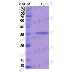 重组DBI蛋白,Recombinant Human DBI, N-GST