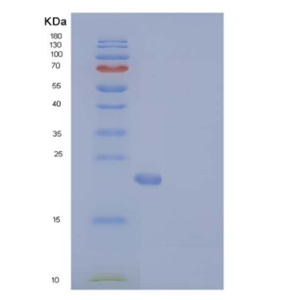 Recombinant Human N6AMT1 / HEMK2 Protein (His tag)