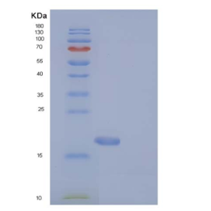 Recombinant Human MAGOH Protein (His tag)