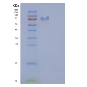 Recombinant Rat PDGFRB / PDGFR-1 Protein (Fc tag),Recombinant Rat PDGFRB / PDGFR-1 Protein (Fc tag)