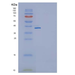 Recombinant Mouse IL11RA / IL11Rα Protein (His tag),Recombinant Mouse IL11RA / IL11Rα Protein (His tag)