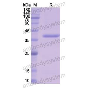 Recombinant Human LDHB, N-His