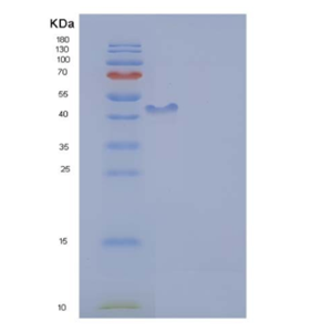 Recombinant Human ICAM-1 Protein