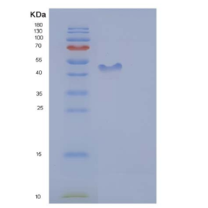 Recombinant Human ICAM-2 / CD102 Protein (His & Fc tag)
