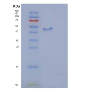 Recombinant Human ICAM-2 / CD102 Protein (His & Fc tag),Recombinant Human ICAM-2 / CD102 Protein (His & Fc tag)