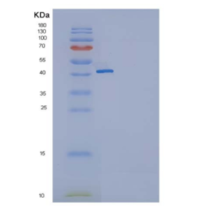 Recombinant Human GITR / TNFRSF18 Protein (Fc tag),Recombinant Human GITR / TNFRSF18 Protein (Fc tag)