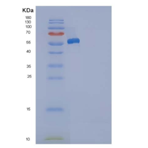 Recombinant Human ANP32A / PHAP1 Protein (His & GST tag)