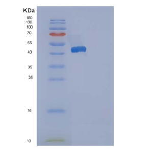 Recombinant Human ACP1 / LMW-PTP Protein (GST tag),Recombinant Human ACP1 / LMW-PTP Protein (GST tag)