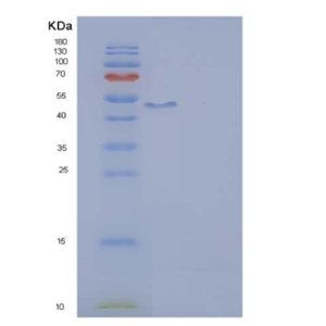 Recombinant Human IL2RG / CD132 Protein (Fc tag)