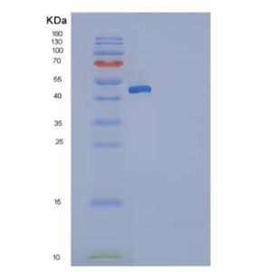 Recombinant Human SerpinG1 / C1 inhibitor / C1IN Protein (His tag)