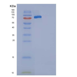 Recombinant Mouse SELP / selectin P / P-selectin Protein (His tag)