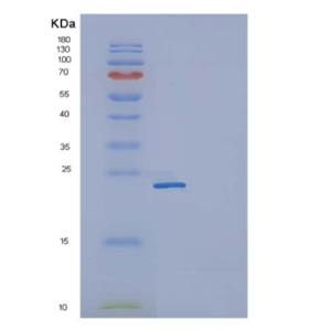 Recombinant Human CD32a / FCGR2A Protein (167 His, His & AVI tag), Biotinylated