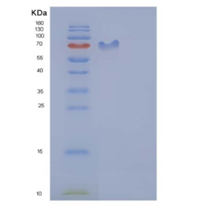 Recombinant Human ICAM-1 / CD54 Protein (His & Fc tag)