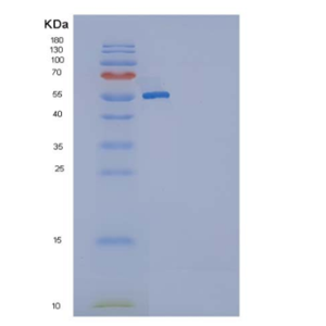 Recombinant Rat KIT / c-KIT Protein (His tag)
