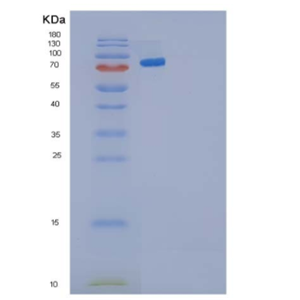 Recombinant Human Cadherin-3/CDH3 Protein(C-6His)