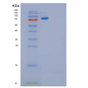 Recombinant Human Cadherin-3/CDH3 Protein(C-6His),Recombinant Human Cadherin-3/CDH3 Protein(C-6His)